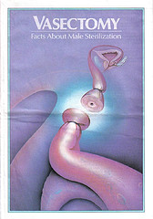 cirurgia de vasectomia 1 (2)