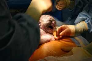 baby being born