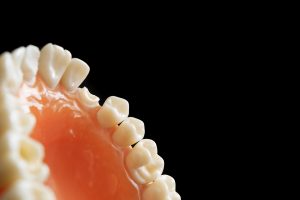 dentadura protese