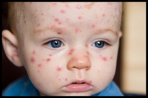 baby with small bumps