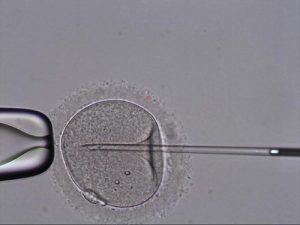 In vitro fertilization