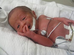 baby in the ICU